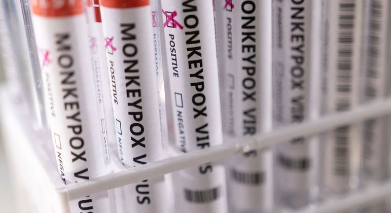 Mais de 30 municípios de SP registram casos confirmados de varíola do macaco