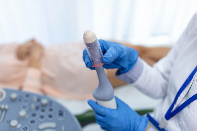 Ultrassonografia
endovaginal: Neste exame, é colocada uma sonda por via vaginal, com o objetivo de avaliar possíveis causas de sangramentos uterinos e dores pélvicas. A ultrassonografia endovaginal deve ser feita quando o ginecologista indicar a sua necessidade. Mulheres que ainda não tiveram a primeira relação sexual devem realizar o exame por via abdominal