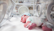 Hospital deve indenizar em R$ 60 mil família de bebê que sofreu lesões no nariz