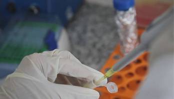 São Paulo vai testar vacina contra crack e cocaína feita pela UFMG (São Paulo vai testar vacina contra crack e cocaína feita pela UFMG)