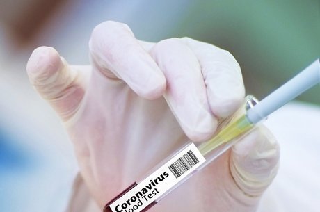 Pesquisador quer vacinação em massa neste ano