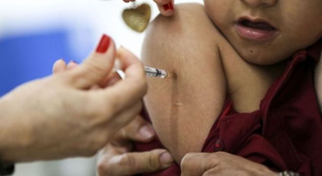 Primeiros sintomas do sarampo são febre alta, acima de 38,5°, com duração de quatro a sete dias, e manchas avermelhadas na pele