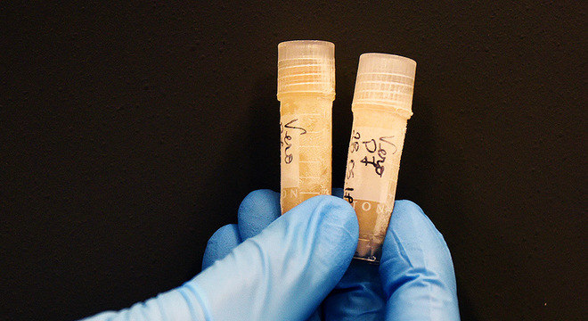 Amostras da vacina desenvolvida na Unicamp