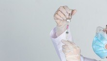 UFMG avança na última fase de testes da vacina contra HIV 