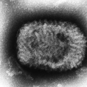 Vírus da varíola