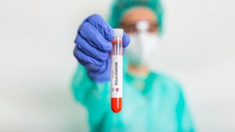 ‘Fulminating Mpox’ threatens AIDS patients, warn researchers – News