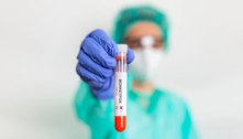 'Mpox fulminante' ameaça pacientes com Aids, alertam pesquisadores 