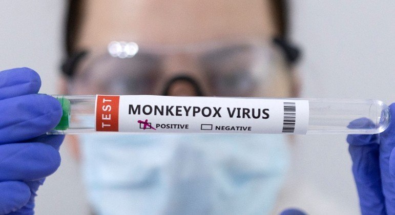 Diagnóstico da varíola do macaco é feito por meio da análise de amostras das lesões da pele