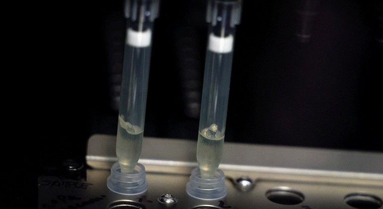 Em laboratórios privados, exame chega a custar R$ 650