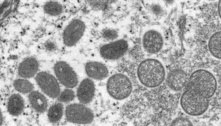 Pesquisadores encontram DNA da varíola do macaco no sêmen de infectados