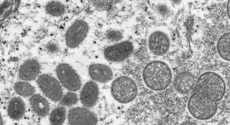 Surto de varíola do macaco iniciou no começo de maio na Europa