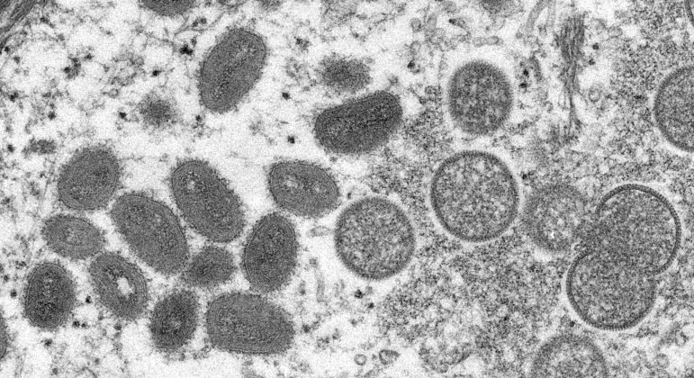 Imagem de partículas maduras do vírus da varíola símia em forma oval e outras imaturas em forma esférica