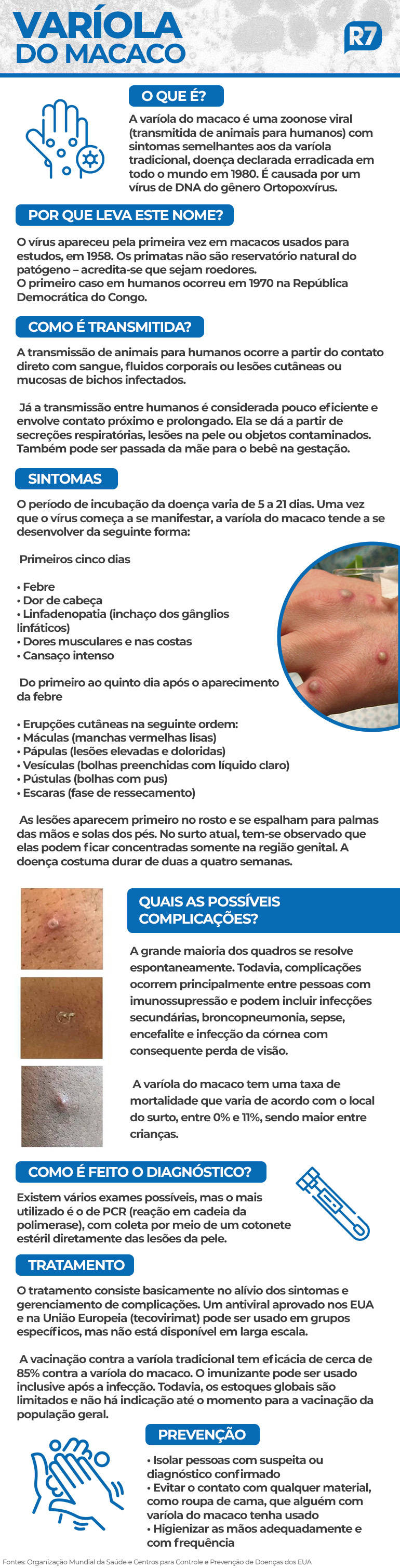 Veja como se prevenir da doença