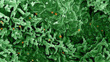 Mais uma pandemia pela frente? Entenda as diferenças entre varíola do macaco e Covid-19