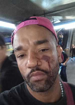 Jefferson Dias acusa guardas de agressão