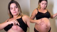 Viih Tube mostra marcas no corpo geradas pela gravidez e faz revelação: 'Ganhei 22 quilos'