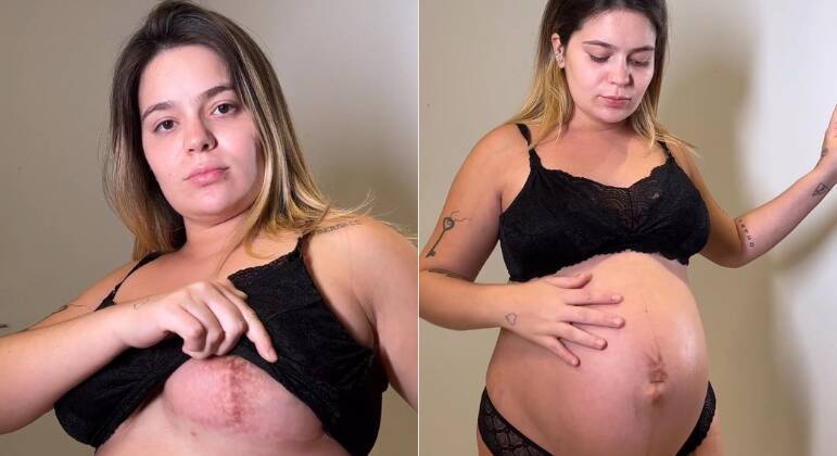 Viih Tube faz tour pelo corpo e mostra cicatrizes decorrentes da gravidez