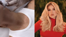Virginia Fonseca aplica Botox no pescoço e faz tratamento no bumbum: 'Prevenção' 