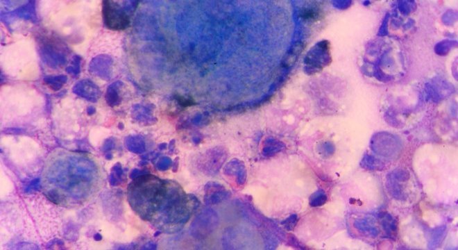 A fagoterapia utiliza o vírus para tratar infecções bacterianas 