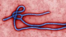 Ebola: Uganda confirma sete casos e uma morte pela doença 