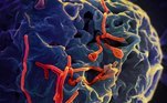 Vírus ebolaO vírus ebola é um 'primo' do Marburg. Aproximadamente 50% dos pacientes morrem. A doença é transmitida por sangue ou fluidos corporais (urina, saliva, suor, fezes, vômito, leite materno, líquido amniótico e sêmen) de alguém infectado, mas também pelo contato com objetos, como roupas de cama, por exemplo. Assim como o Marburg, o reservatório natural do vírus são morcegos frugívoros (que se alimentam de frutas) encontrados em alguns países africanos