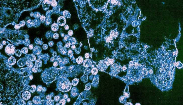 A febre de Lassa, como é chamada a doença de quem é infectado, tem como sintomas febre leve, mal-estar geral, fraqueza e dor de cabeça na maioria dos pacientes. Cerca de 20% dos indivíduos infectados com o vírus Lassa podem ter complicações, como hemorragia nas gengivas, nariz e olhos, além de dificuldade respiratória, dor no peito e nas costas e choque. A morte pode ocorrer dentro de duas semanas após o início dos sintomas devido à falência de múltiplos órgãos. A sequela mais comum é a surdez