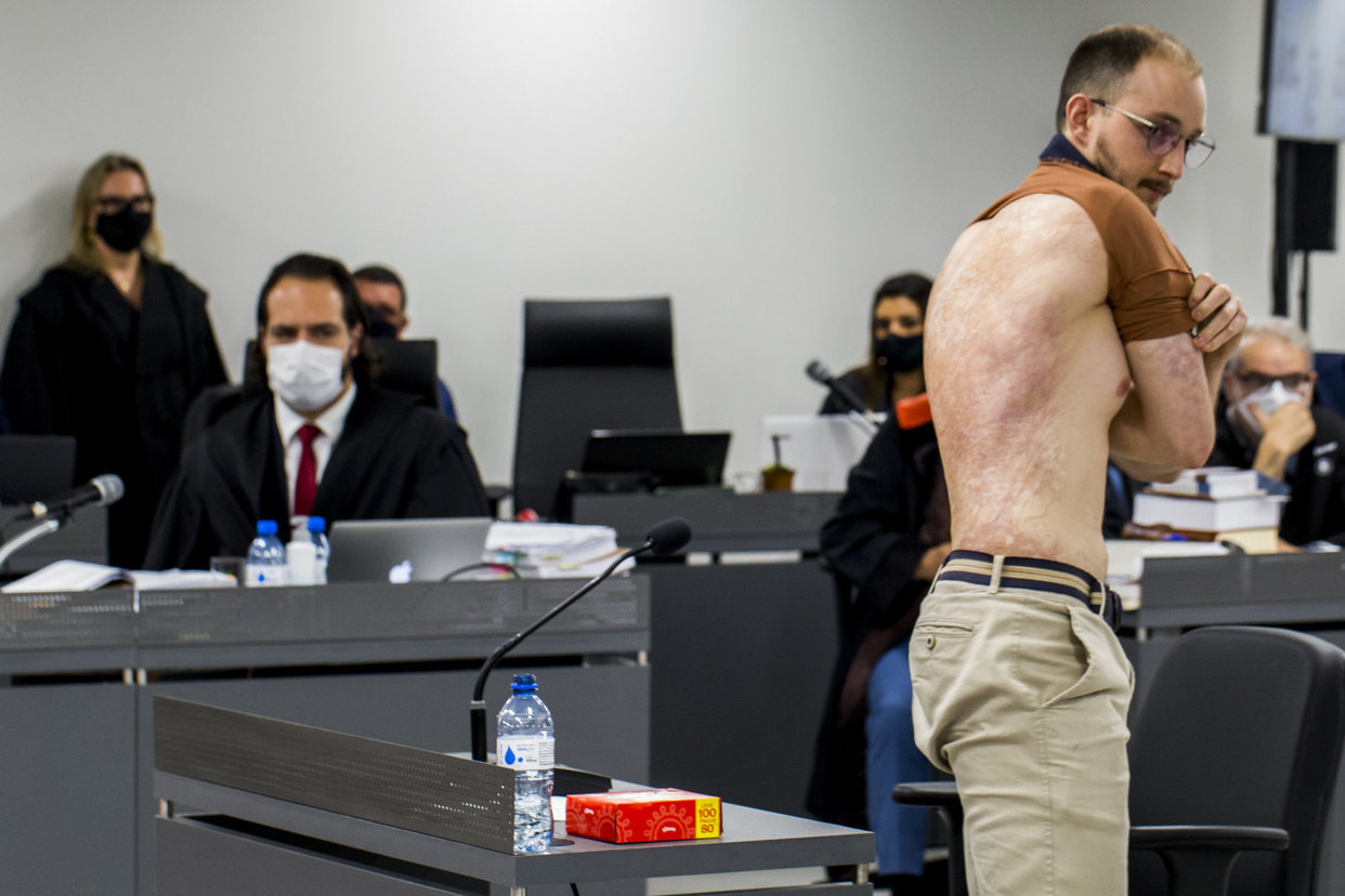 Vítima mostra cicatrizes deixadas pelo incêndio da Kiss (TJ-RS)