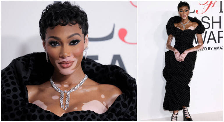 Winnie Harlow