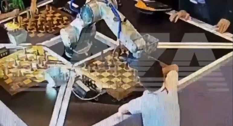 Robô prendeu o dedo do menino russo por mais de 15 segundos