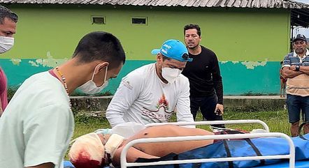 Três yanomamis foram baleados durante ataque de garimpeiros