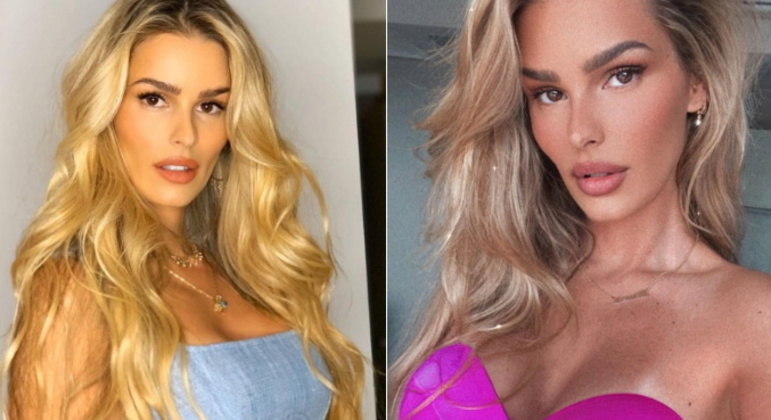 Yasmin BrunetA modelo e empresária recebia muito uma mesma pergunta de seus seguidores nas redes sociais, se ela tinha retirado uma costela para afinar a silhueta. Yasmin desmentiu o boato: 