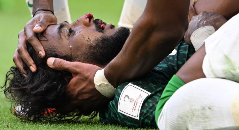 Yasser Al-Shahrani, da Arábia Saudita, recebe atendimento após levar uma trombada do goleiro