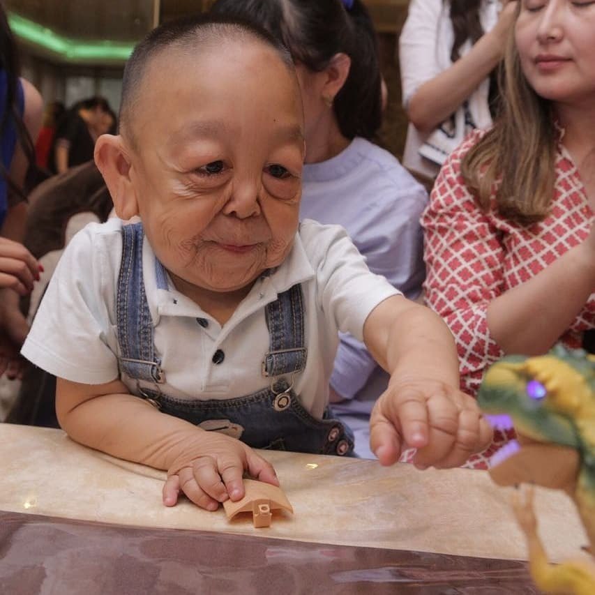 Benjamin Button Doenca Rara Faz Menino De 6 Anos Ter Cara De Idoso Fotos R7 Hora 7