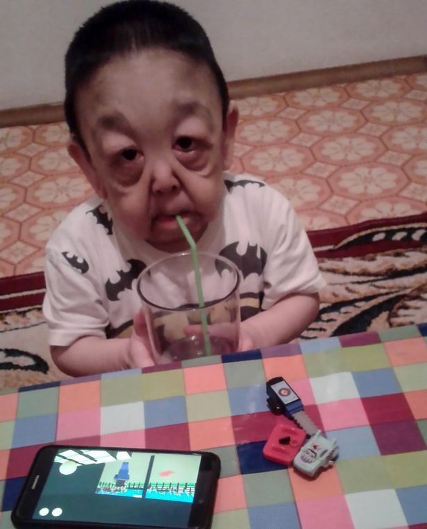 Benjamin Button Doenca Rara Faz Menino De 6 Anos Ter Cara De Idoso Fotos R7 Hora 7