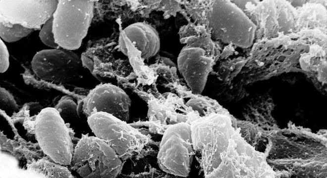 Yersinia pestis, a bactéria causadora da peste bubônica